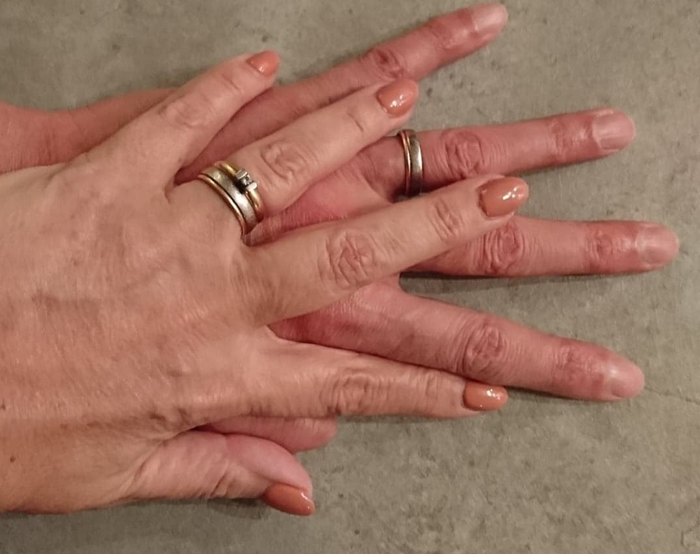 händer som symboliserar mental och fysisk beröring