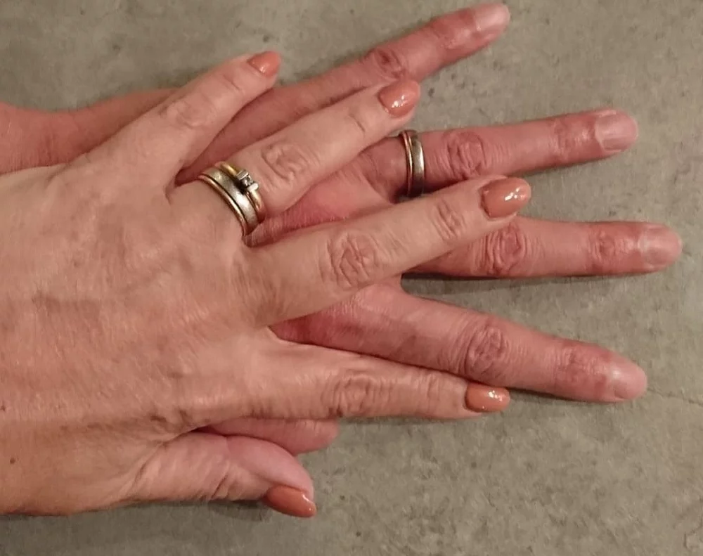 händer som symboliserar mental och fysisk beröring